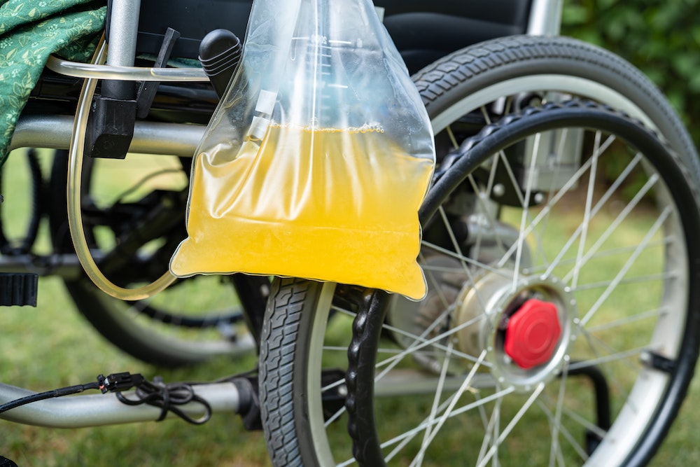L'importance de la recherche et développement pour l'industrie des poches urinaires